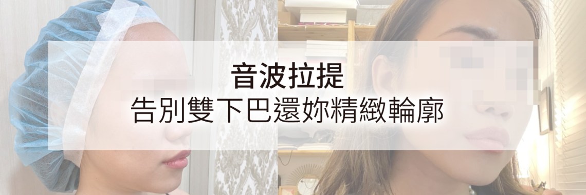 article_image73